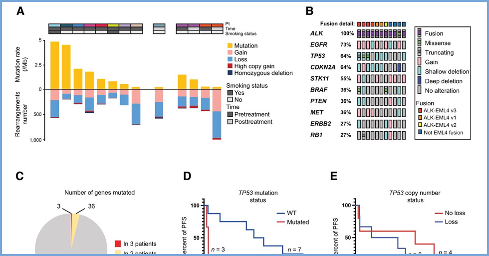 Analysis of the genomic landscape in ALK+ NSCLC patients identifies novel aberrations associated with clinical outcomes